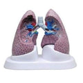 Wards Natural Science Model Lung Set GPI Anatomicals Each - 470160-258