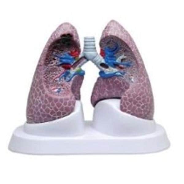 Wards Natural Science Model Lung Set GPI Anatomicals Each - 470160-258