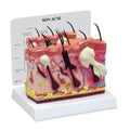 Wards Natural Science Model Skin GPI Anatomicals Each - 470160-270