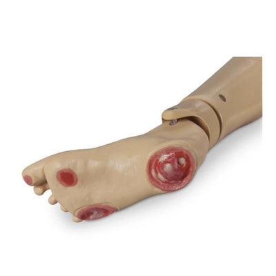 Nasco Healthcare, Inc Optional Pressure Ulcer Foot Simulator Training Life/form Each - LF04041
