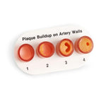 Nasco Healthcare, Inc Artery Sections Model Anatomical Each - WA09742