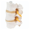 Fabrication Enterprises 3 Lumbar Vertebrae Model Anatomical Each - 35400