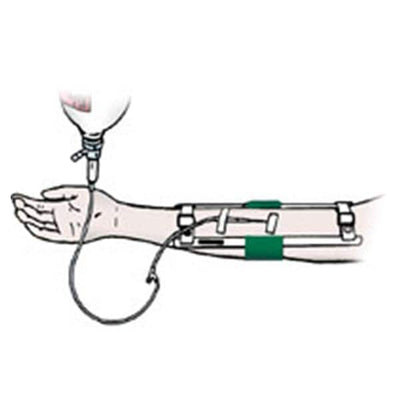 ACE Surgical Supply Immobilizer Adult Elbow Size 11" Each - 8372160