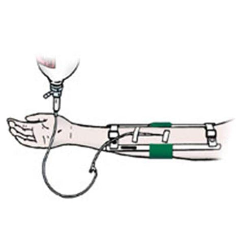 ACE Surgical Supply Immobilizer Child Elbow Size 7" Each - 8372161