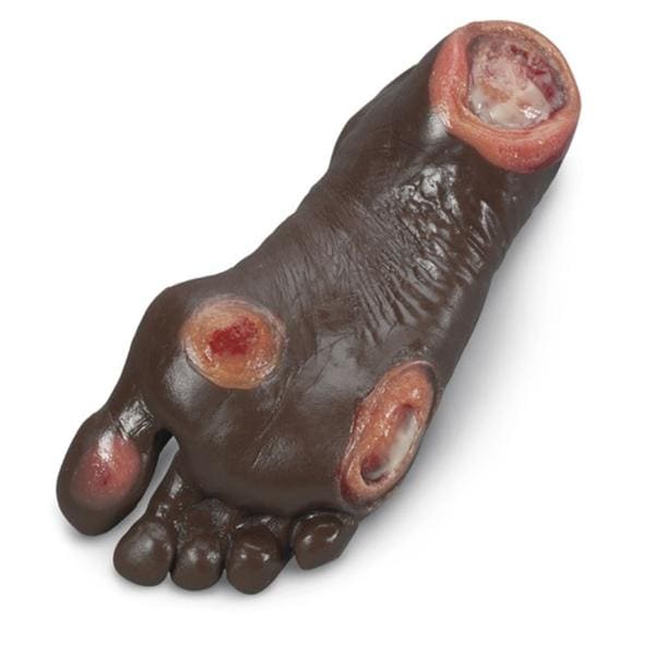Nasco Healthcare, Inc Foot Pressure Ulcer Model Anatomical Elderly Each - LF00944