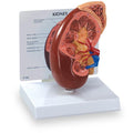 Nasco Healthcare, Inc Kidney/Adrenal Gland Model Anatomical Right Each - WA21315