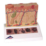 American 3B Skin Cancer Model Anatomical Each - Z13802