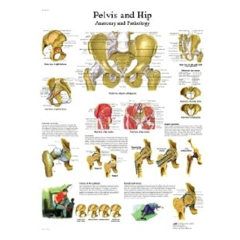 Fabrication Enterprises Chart Hip and Pelvis 20x25" Each - 12-4617L