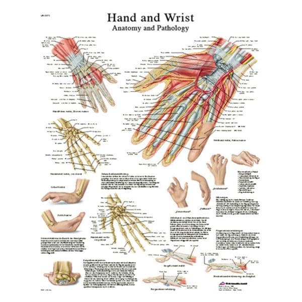 Fabrication Enterprises Chart Hand And Wrist 20x25" Each - 12-4609L