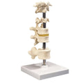 Fabrication Enterprises Vertebra Column Model 6-Part Each - 34304