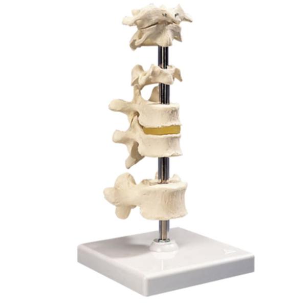 Fabrication Enterprises Vertebra Column Model 6-Part Each - 34304