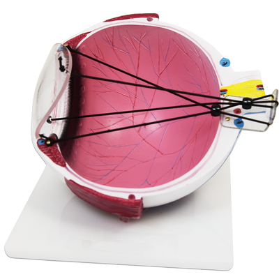 ASTIGMATISM EYE MODEL