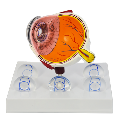 INTRAOCULAR EYE MODEL