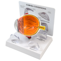 CORNEAL EYE MODEL