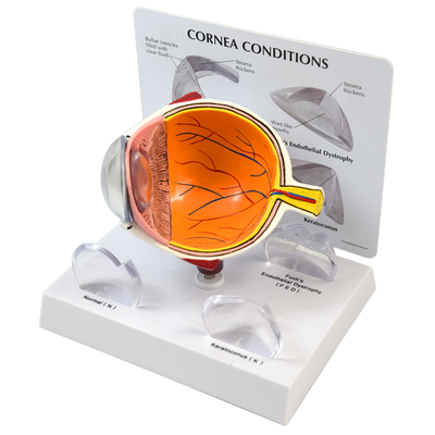 CORNEAL EYE MODEL