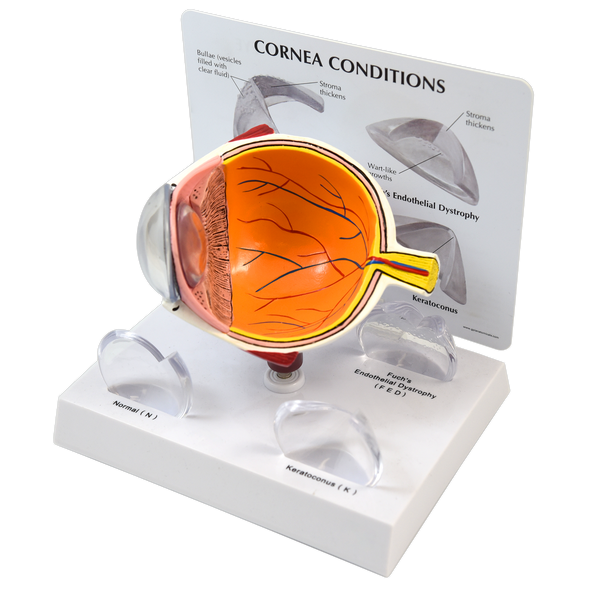CORNEAL EYE MODEL