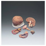 Wolters Kluwer Health Inc Brain Model Anatomical Basic Adult Each - C20C