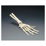 Wolters Kluwer Health Inc Wired Hand Model Anatomical Right Adult Each - OS32E