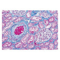 Richard Masson's Trichrome Stain Kit Each - Allan Scientific - 87019