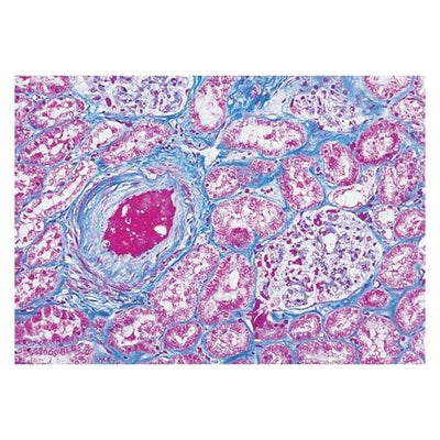 Richard Masson's Trichrome Stain Kit Each - Allan Scientific - 87019