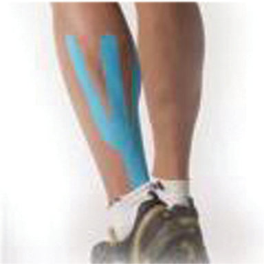 Spider Tech tape, calf and arch
