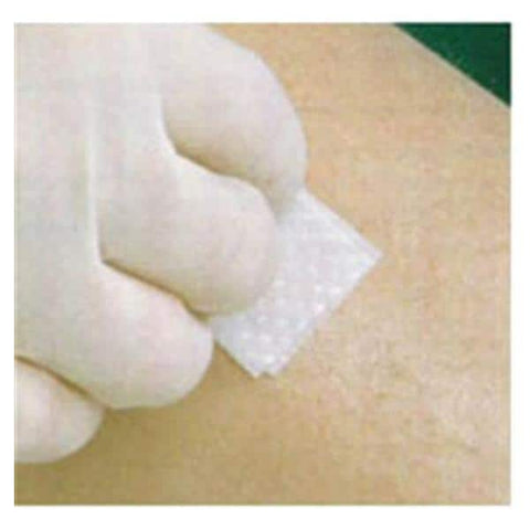 Smith & Nephew Wound Care Wipe Protectant Skin-Prep No-Sting Alcohol-Free 20X50/Ca - 59420600