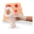 Nasco Healthcare, Inc Model Ostomy Care BIOLIKE2 Tissue Each - SB23501