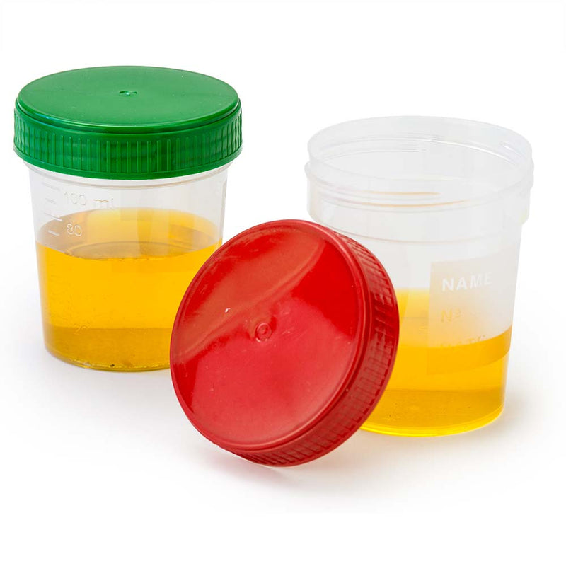 Globe Scientific Specimen Container, 4oz, with Full Turn Green and Red Separate Screwcap, Frosted Writing Area, Non-Sterile, PP, Graduated