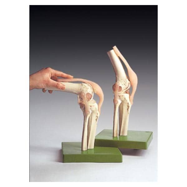 Wolters Kluwer Health Inc Functional Knee Joint Model Anatomical Right Adult Each - NS-50