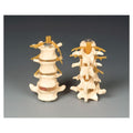 Wolters Kluwer Health Inc Four-Part Lumbar Set Model Anatomical Budget Adult Each - CHLS4