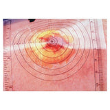 Alimed, Inc Sheet Measuring For Wound 250/BX - 70831