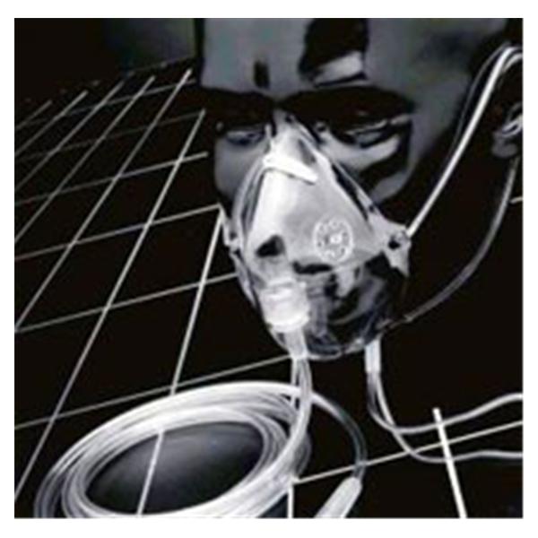 Salter Labs, Inc Mask Oxygen Pediatric 50/Ca - 1123-0-50