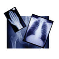 Medlink Imaging Film X-Ray 15x30cm 100/Bx, 5 BX/CA - 55BHW