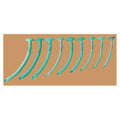 SunMed Airway Nasopharyngeal Individual Robertazzi Adult 20Fr Flexible Green Each, 10 Each/PK - 1-5075-20