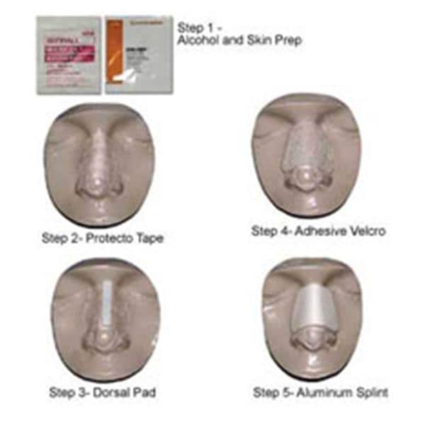 Summit Medical Splint Post-Op Denver Series 5000 Non-Kit Nasal Bg 65x35 Size Small/Medium 10/Bx - 10500010NKS
