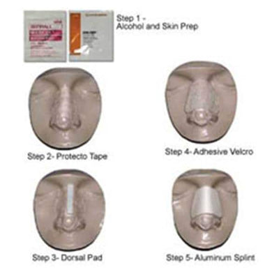 Summit Medical Splint Post-Op Denver Series 5000 Non-Kit Nasal Bg 65x35 Size Small/Medium 10/Bx - 10500010NKS