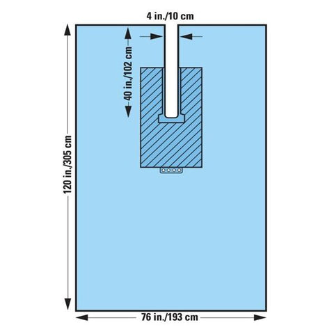 O & M Halyard Sheet Surgical Fenestrated 120x76" 17/Ca - 89301