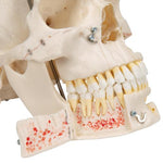 Deluxe Human Demonstration Dental Skull Model, 10 part - 3B Smart Anatomy