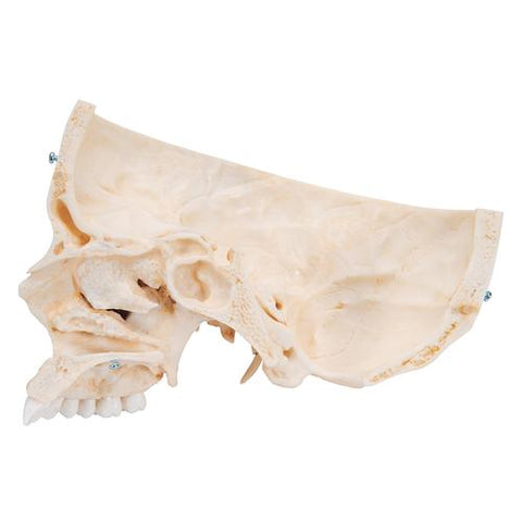 BONElike™ Human Bony Skull Model, 6 part - 3B Smart Anatomy