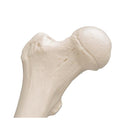 Human Femur - 3B Smart Anatomy