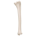 Human Tibia Model- 3B Smart Anatomy