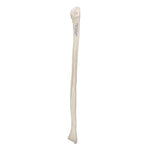 Human Fibula Model - 3B Smart Anatomy