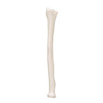 Human Radius Model - 3B Smart Anatomy