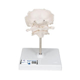 Atlas & Axis Model with Occipital Plate, Wire Mounted, on Removable Stand - 3B Smart Anatomy