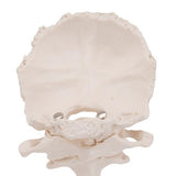 Atlas & Axis Model with Occipital Plate, Wire Mounted, on Removable Stand - 3B Smart Anatomy