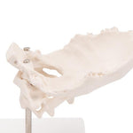 Atlas & Axis Model with Occipital Plate, Wire Mounted, on Removable Stand - 3B Smart Anatomy