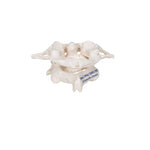 Human Atlas & Axis Model, Wire Mounted - 3B Smart Anatomy