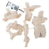 5 Human Vertebrae, Loosely Threaded on Nylon (atlas, axis, cervical, thoracic, lumbar) - 3B Smart Anatomy