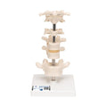 Model of 6 Human Vertebrae, Mounted on Stand (atlas, axis, cervical, 2x thoracic, lumbar) - 3B Smart Anatomy
