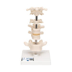 Model of 6 Human Vertebrae, Mounted on Stand (atlas, axis, cervical, 2x thoracic, lumbar) - 3B Smart Anatomy